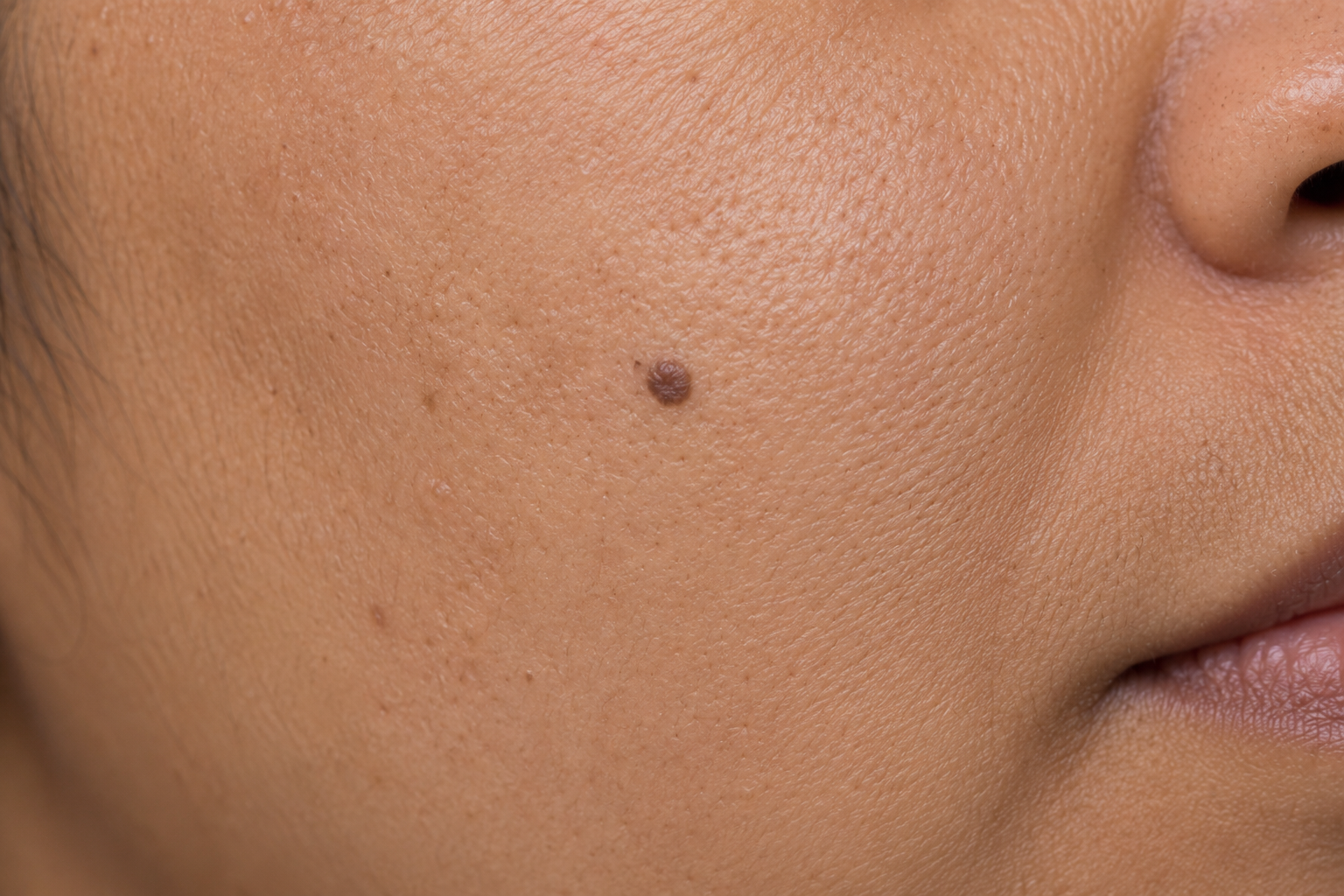 Lesions